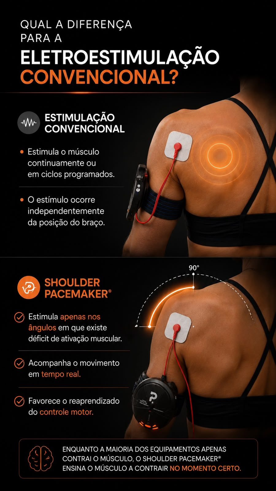 Shoulder Pacemaker – Qual a diferença?