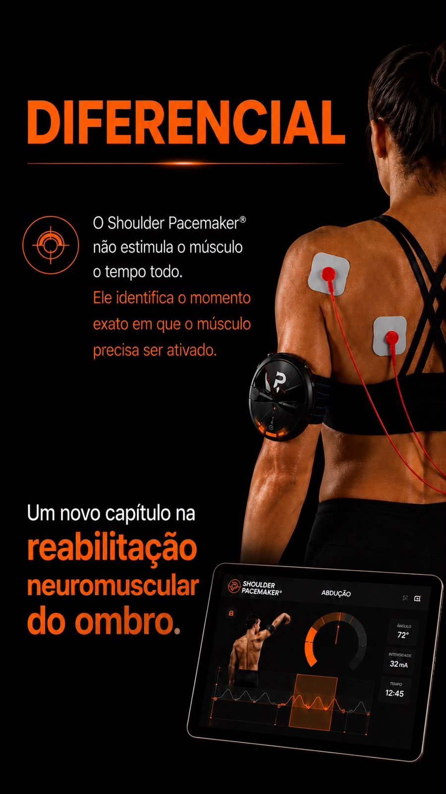 Shoulder Pacemaker – Diferencial